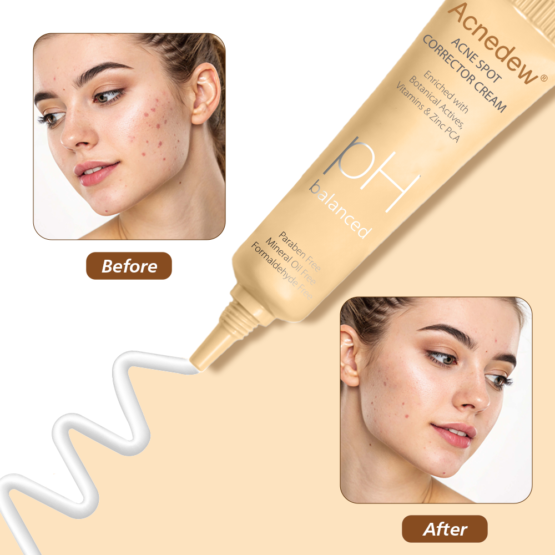 Acnedew Acne Spot Corrector Cream 10 gm_05